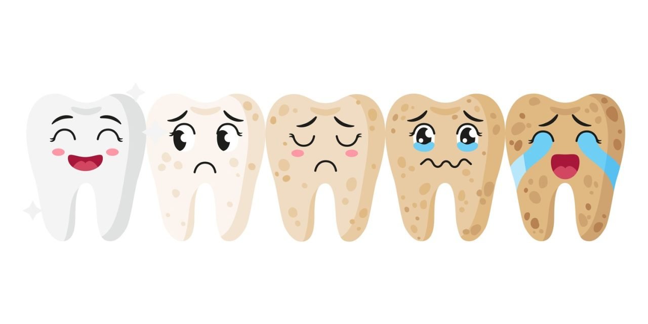 ¿Cómo puedes evitar manchas en los dientes?